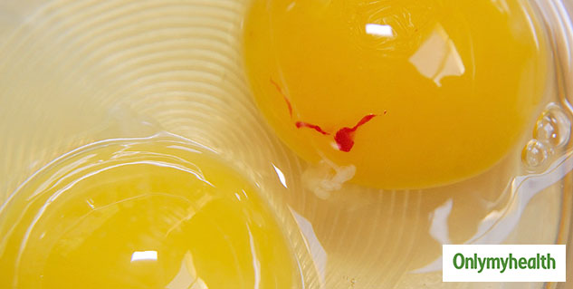 Eggs With_ Blood_Spots