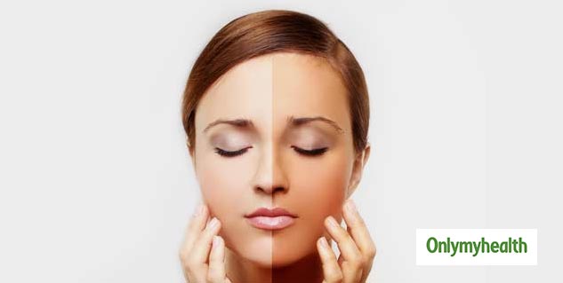 Holistic Skin Healing for Uneven Tone Fast