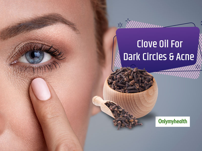 Telugu Fashion News Today-Clove Oil To Remove Dark Circles