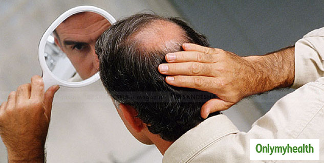 Inside1_hairfallandbaldness