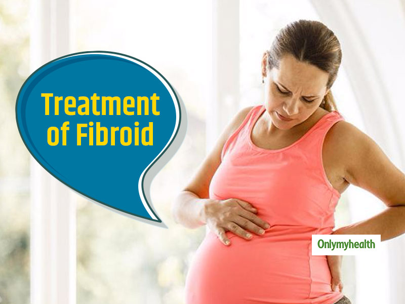 Understand All About Fibroid During Pregnancy and Its Possible Treatment