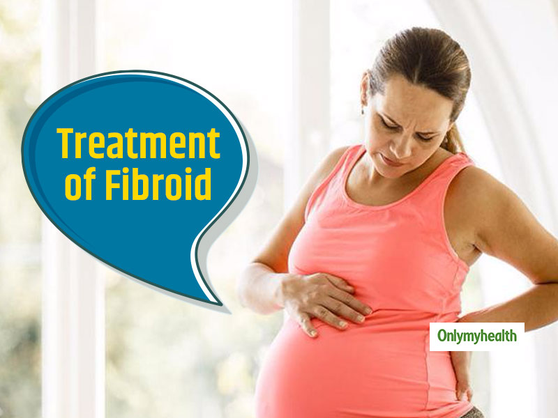 Understand All About Fibroid During Pregnancy And Its Possible Treatment Onlymyhealth 