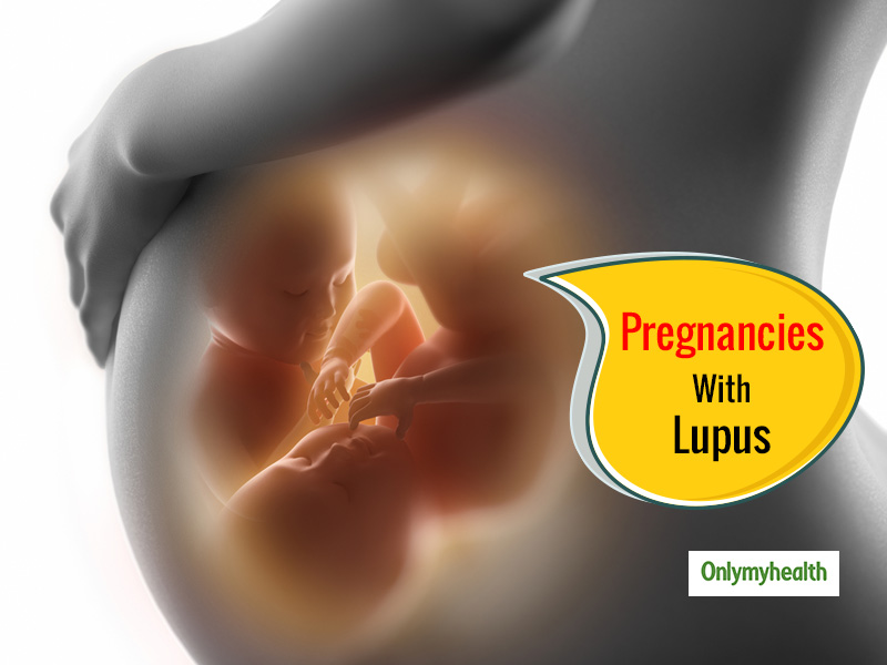 Having a Healthy Pregnancy with Lupus