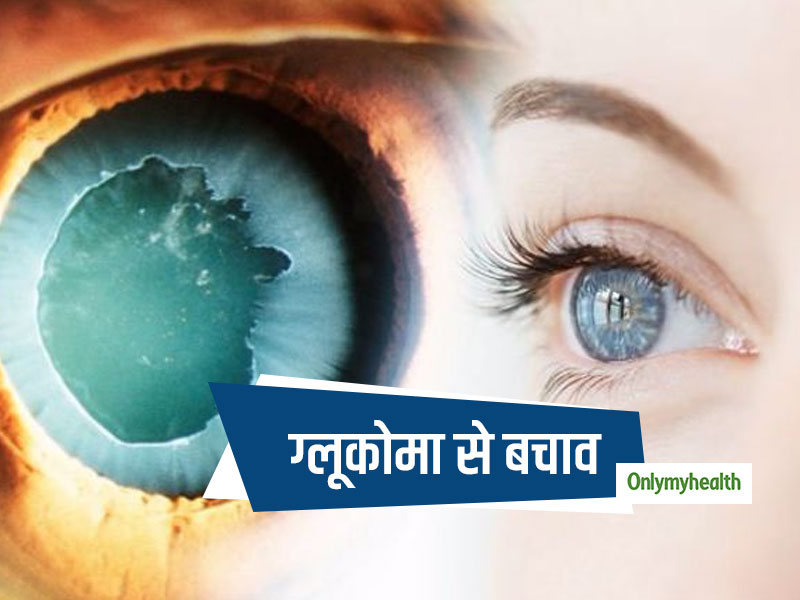 आंखों के अंधेपन (ग्‍लूकोमा) से बचाव के लिए अपनाएं ये 5 उपाय, रहेगी आंखों की रौशनी हमेशा बरकरार 