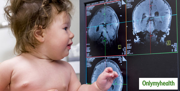 pregnancy-infection-baby-brain