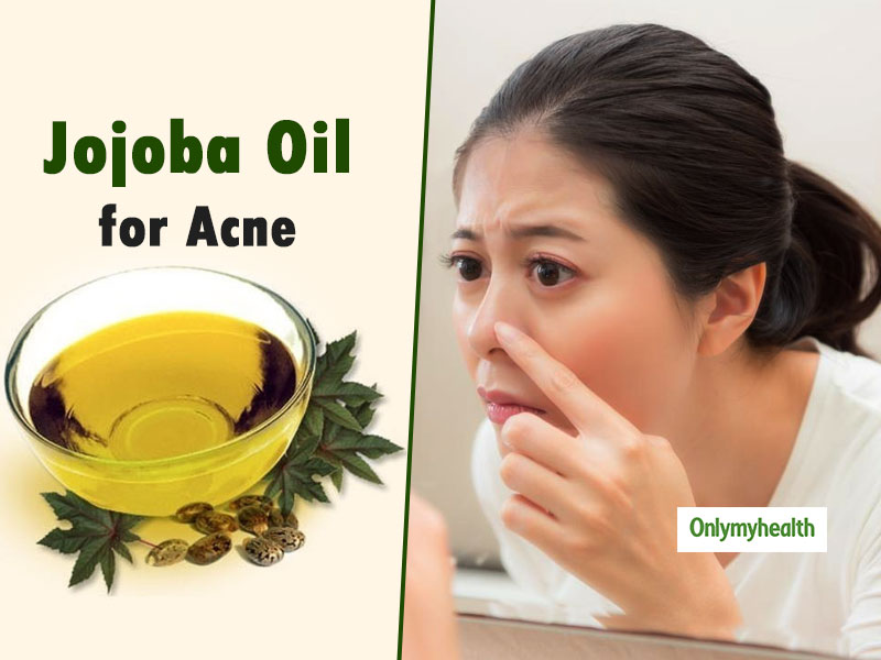 Treat Your Acne Naturally Using Jojoba Oil