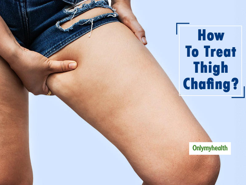 Avoid Thigh Chafing with these 7 Home Remedies