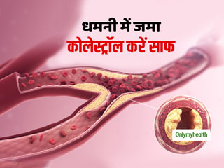 धमनियों में जमे कोलेस्ट्रॉल को साफ करते हैं ये 5 फूड्स, तेजी से घटेंगे LDL और ट्राईग्लिसराइड्स