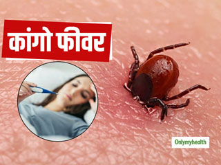 जानलेवा कांगो फीवर से गुजरात में 3 की मौत, जानें क्‍या है कांगो बुखार के लक्षण व बचाव के उपाय 