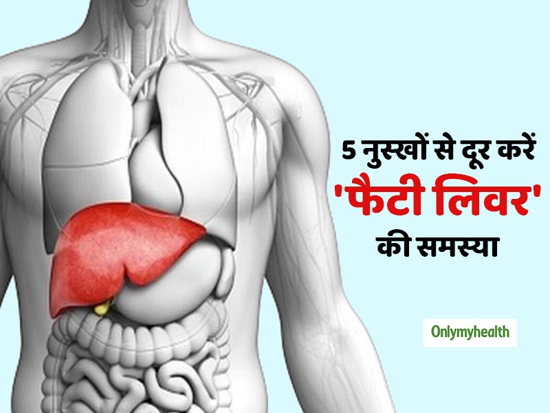लिवर में सूजन (फैटी लिवर) की समस्या को इन 5 तरीकों से करें दूर, लिवर रहेगा हमेशा दुरुस्त 