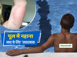 पूल में नहाने से खराब हुई त्वचा तो डॉक्टरों ने शरीर से निकाल ली 25 फीसदी स्किन, किडनी भी हो गईं फेल  