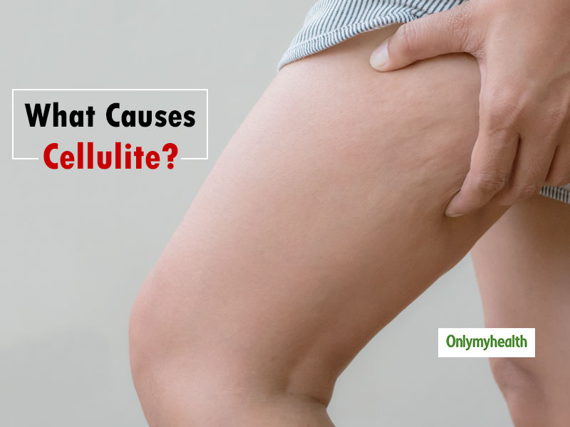 8 Everyday Habits That Might Give You Cellulite