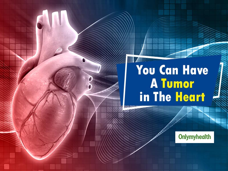 Everything You Need To Know About Heart Tumors | OnlyMyHealth