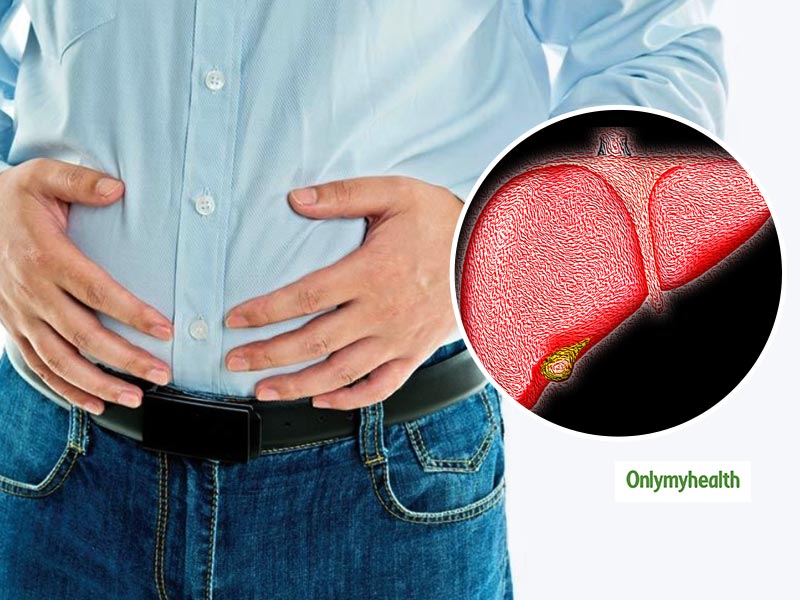 stomach-bloating-can-be-a-sign-of-an-enlarged-liver-know-the-reason