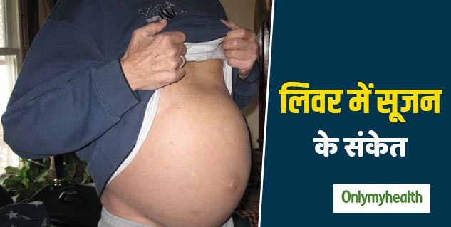 पेट का फूलना लिवर में सूजन का है कारण 