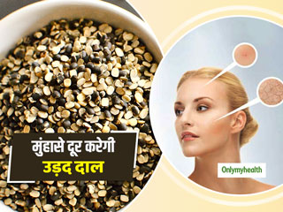Skin Care: मुंहासों और दाग-धब्‍बों से छुटकारा पाने के लिए इन 3 तरीकों से करें उड़द दाल का इस्‍तेमाल 