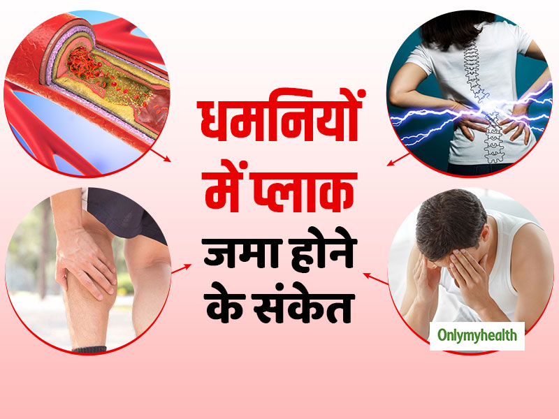 Clogged Arteries Signs: धमनियों में प्‍लाक जमा होने के संकेत हैं पीठ में दर्द और स्‍तंभन दोष, जानें इससे बचने के उपाय