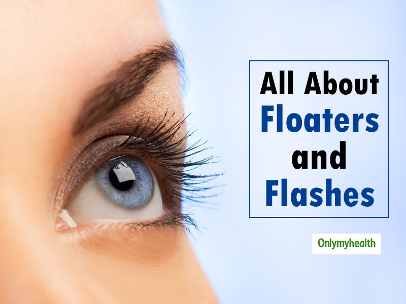 floaters-and-flashes-in-the-eyes-causes-and-treatment