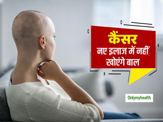 New Cancer Treatment: कैंसर के नए इलाज से नहीं खोएंगे मरीजों के बाल, कीमोथेरेपी के दुष्प्रभाव होंगे कम