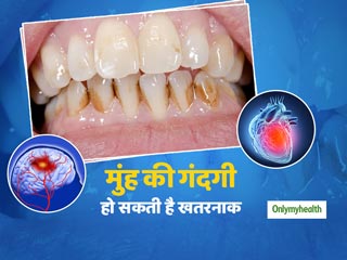 मुंह की ठीक से सफाई न करने वालों को 'ब्रेन स्ट्रोक' का होता है खतरा, जानें कैसे करें मुंह की सफाई