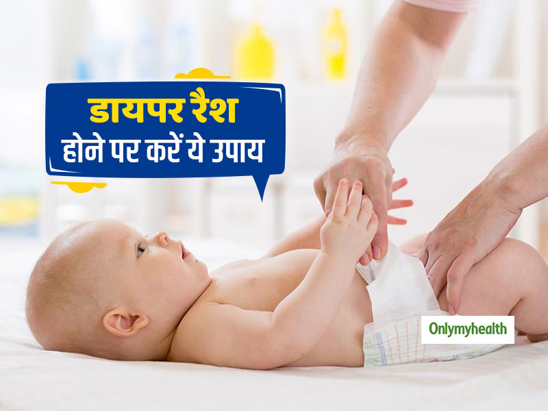 डायपर के कारण शिशु को हो गए हैं रैशेज तो करें यह उपाय, साफ रहेगी त्वचा