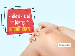 शरीर पर पड़े ये धब्बे कहीं बिगाड़ न दे आपकी सेहत, इन 3 घरेलू नुस्खों से करें इन्हें दूर 