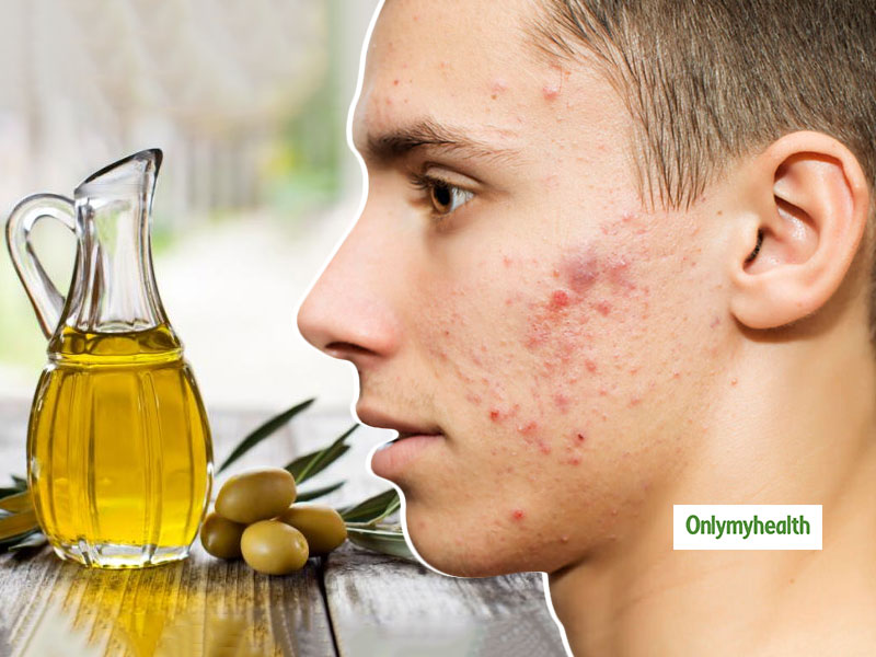 Olive Oil For Scars: ऑलिव ऑयल से करें चेहरे के दाग-धब्‍बों का उपचार, मिलेगी दमकती त्‍वचा