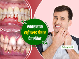 Hypertension Signs: मुंह में दिखने वाले ये 5 लक्षण हो सकते हैं हाई ब्लड प्रेशर का संकेत, युवा रहें सावधान