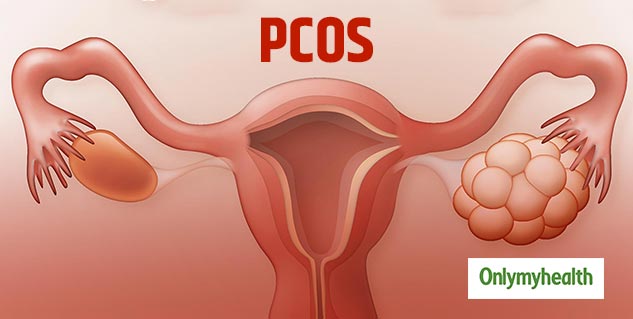 PCOS