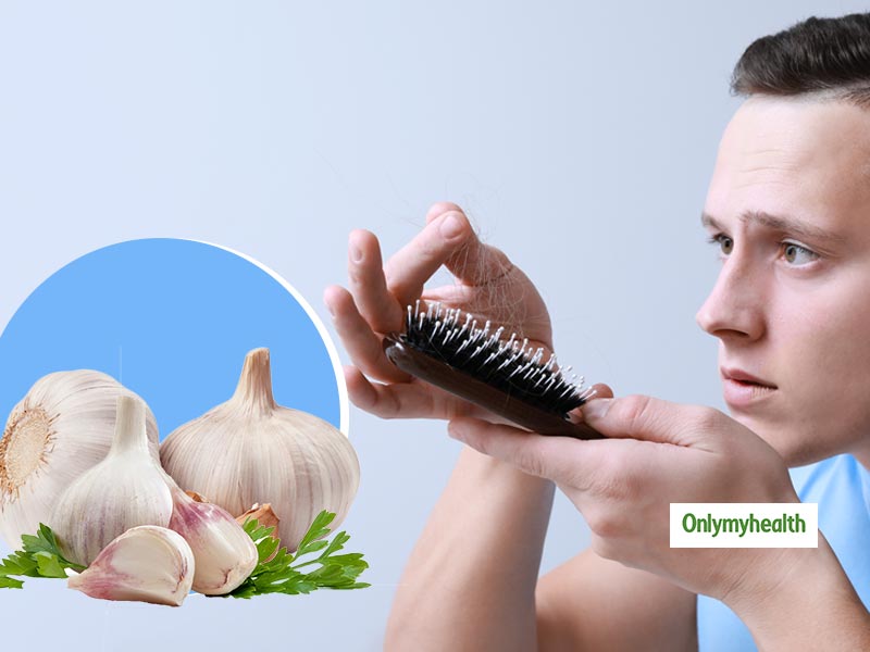 Prevent hair fall: बालों का झड़ना रोक देता है लहसुन वाला शैम्‍पू, जानें बनाने और लगाने का तरीका