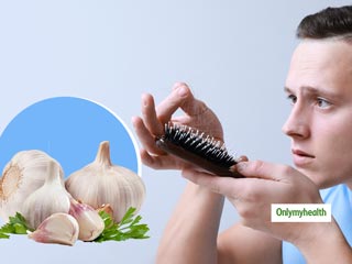 Prevent hair fall: बालों का झड़ना रोक देता है लहसुन वाला शैम्‍पू, जानें बनाने और लगाने का तरीका