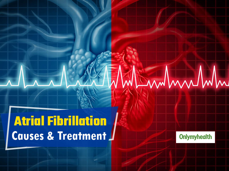 World Heart Day 2019: All You Need To Know About Atrial Fibrillation ...