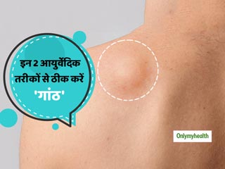 शरीर पर उभरी हुई गांठ  (Lipoma) को दूर करने में कारगर है ये 2 आयुर्वेदिक तरीके, जानें गांठ को हटाने का तरीका