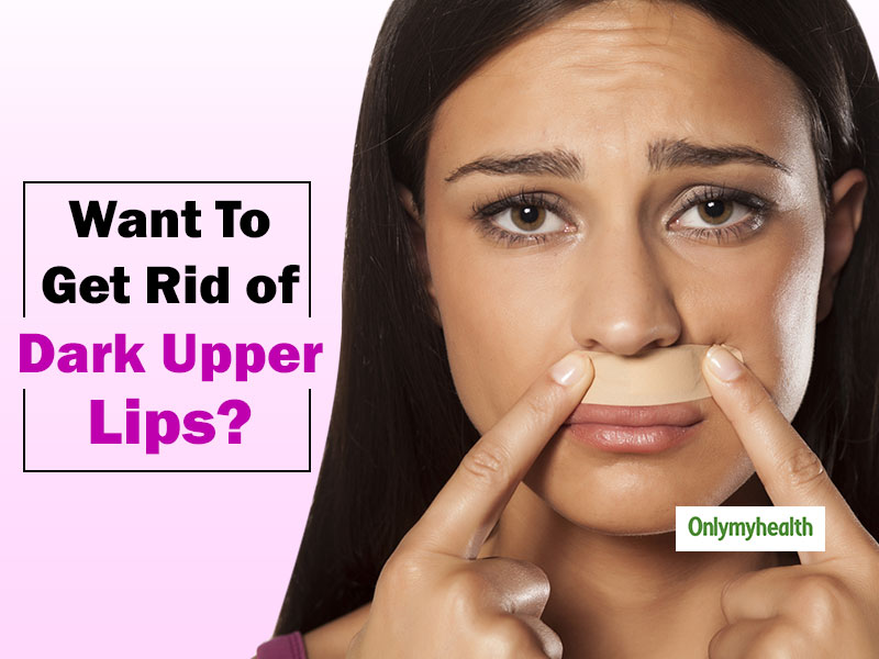 home-remedies-to-lighten-dark-upper-lips-using-kitchen-ingredients