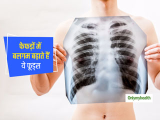 फेफड़ों में बलगम बढ़ाते हैं ये 5 आहार, जानें क्यों जरूरी है बलगम का कम होना और कैसे निकालें इसे बाहर
