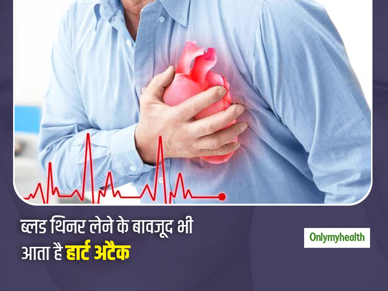 खून पतला करने वाली दवाईयां खाने के बाद भी क्यों आता है हार्टअटैक, कार्डियोलॉजिस्ट से जानें अटैक के 3 कारण