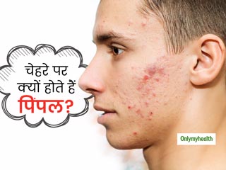 चेहरे पर ही क्यों ज्यादा निकलते हैं पिंपल्स? जानें इससे बचने के लिए 6 जरूरी बातें