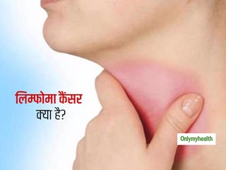 गले में सूजन और दर्द हो सकता है लिम्फोमा कैंसर का संकेत, जानें इसके लक्षण और कारण