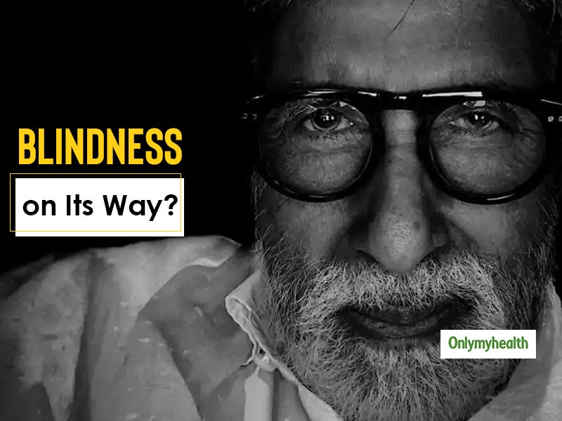 Legendary Actor Amitabh Bachchan Expresses Concern Over Blindness, Here's What The Doctors Said With Care Tips