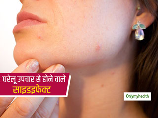 स्किन को चमकाने के लिए घर में रखी इन 4 आम चीजों से न करें घरेलू नुस्खे, नेचुरल ग्लो भी चेहरे से हो जाएगा दूर