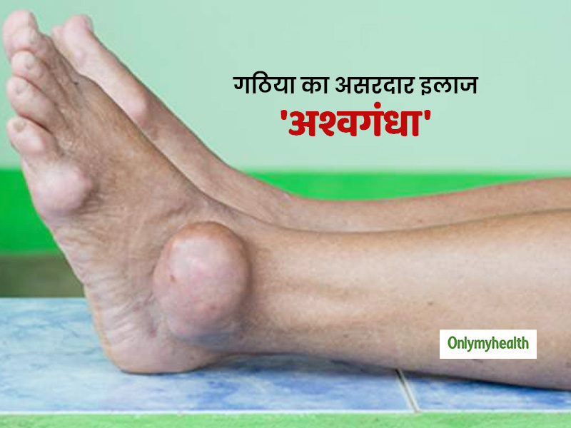 Ashwagandha For Gout Pain: गठिया के दर्द और जोड़ों की सूजन दूर कर सकता है अश्वगंधा, जानें असरदार तरीका