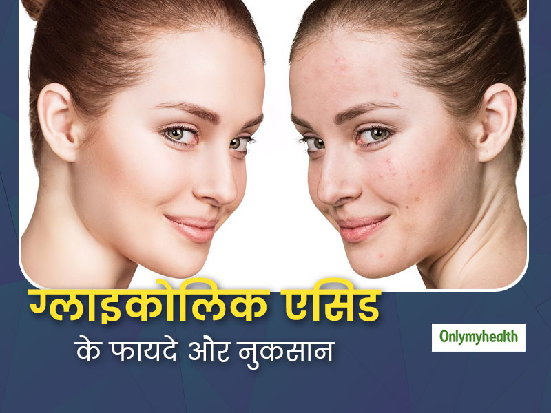 Skin Care: ग्लाइकोलिक एसिड त्वचा के लिए कितना फायदेमंद या नुकसानदायक है?