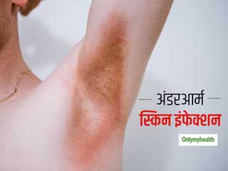 Summer tips: पसीने के कारण अंडरआर्म्स में स्किन इंफेक्शन का है खतरा, इन बातों का ध्यान रखें और बरतें सावधानी