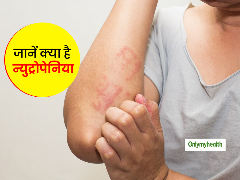 न्युट्रोपेनिया के कारण हो सकता है आपका इम्यून सिस्टम कमजोर, जानें क्यों होती है ये समस्या