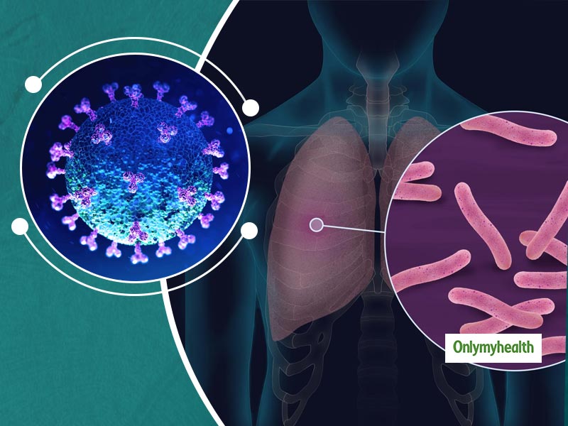 Know Why Tuberculosis Can Be Dangerous Than Coronavirus