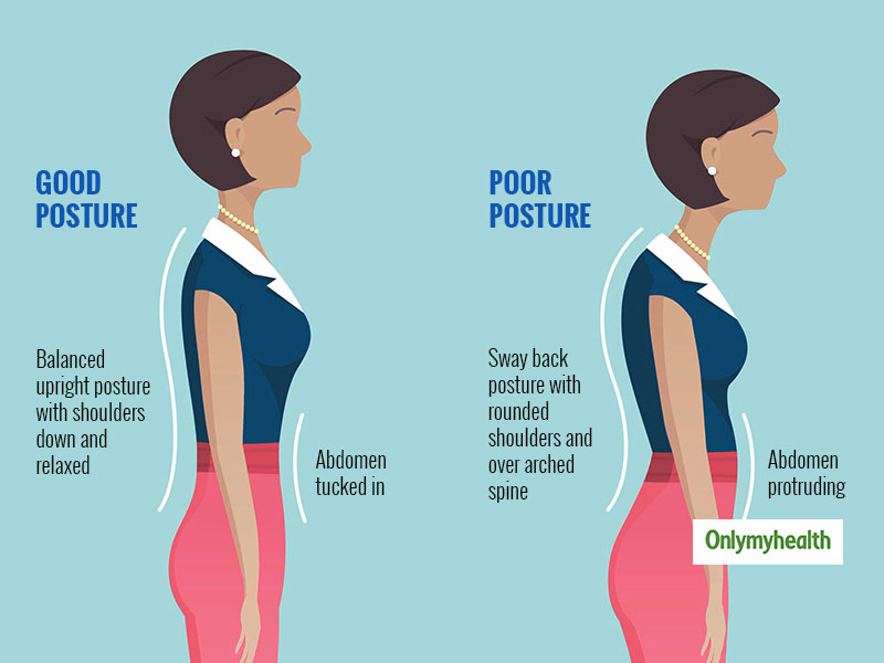 Definition of posture (left : good posture, right : poor posture