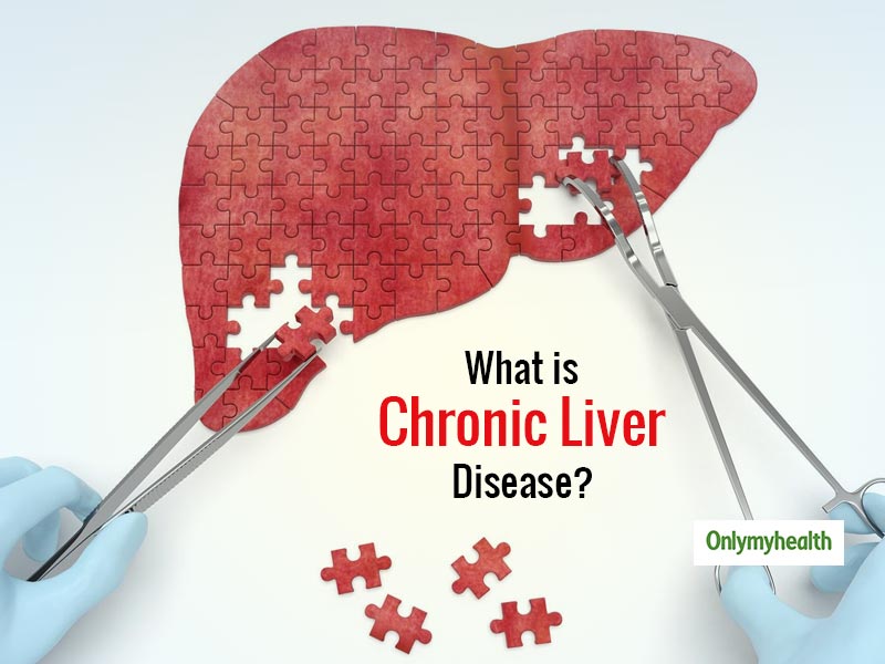 chronic-liver-disease-signs-and-symptoms-gastroenterologist-tips-to