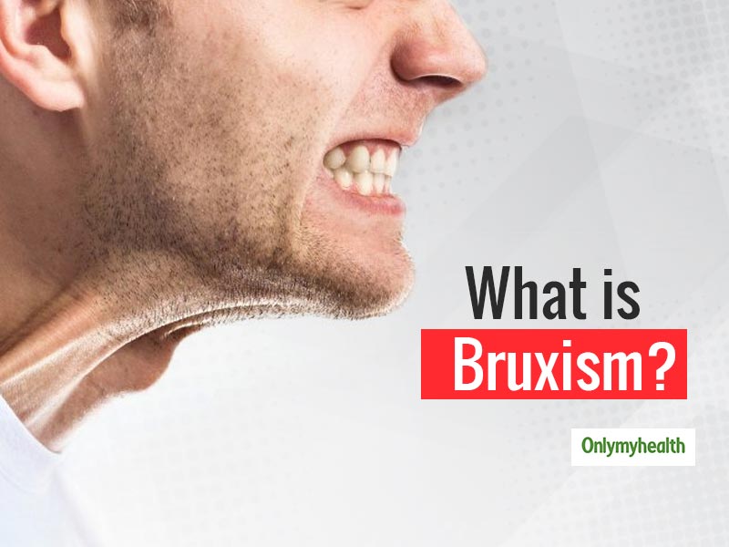 Bruxism Or The Habit Of Clenching Teeth Is Bad For Your Health, Get Rid Of This In Simple Ways