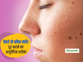 Ayurvedic Treatment Of Black Spots: चेहरे पर जिद्दी ब्लैक स्पॉट? इन आयुर्वेदिक तरीकों से पाएं जवां फेयर स्किन