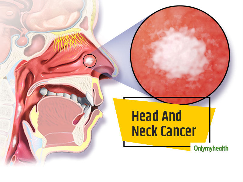 throat cancer from tobacco